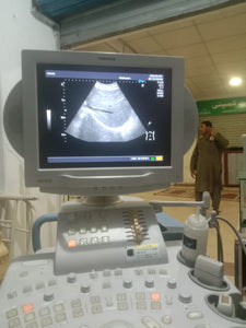 Toshiba Namio XG Ultrasound System